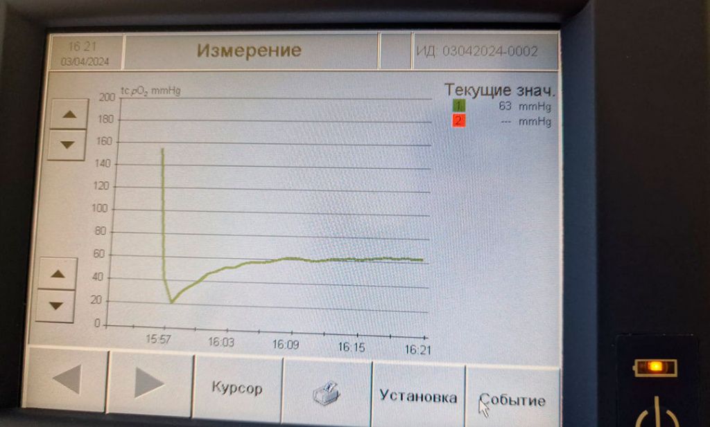 Чрескожное напряжение кислорода для прогнозирования заживления ран